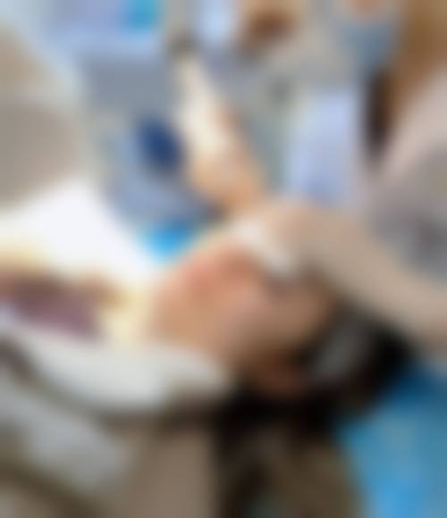 韩海成医生擅长的皮肤治疗技术