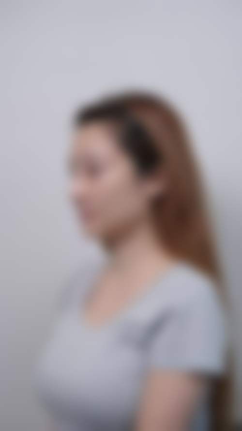 盐城美得丽德医疗整形医院怎么样特色项目及技术优势