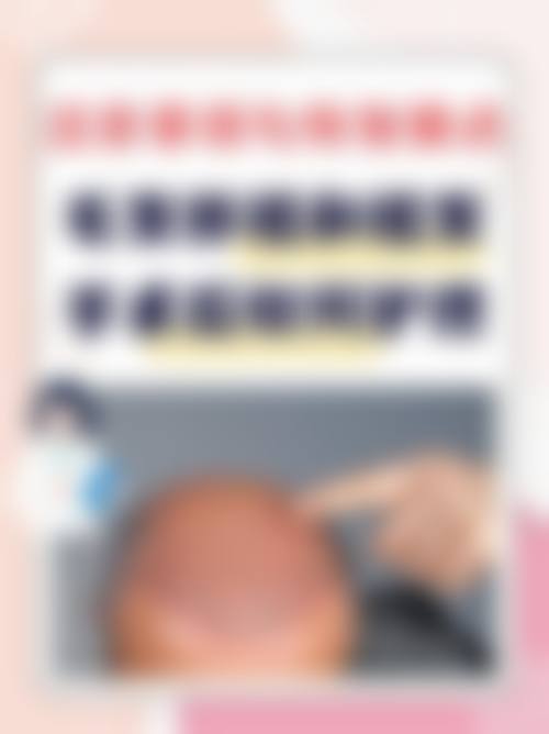 牛改医生的患者信赖