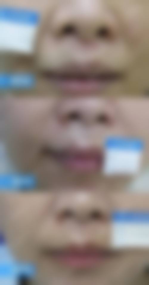 营口丽影医学美容诊所怎么样求美者反馈