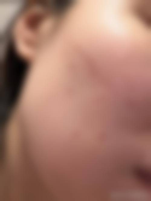 曲靖市中医医院皮肤美容科怎么样医生团队实力