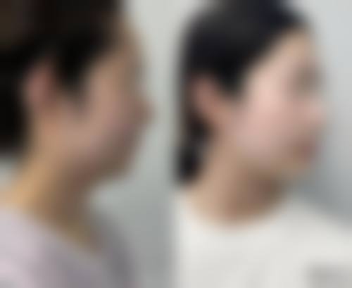 开封鼓楼靳建立整形医疗美容诊所怎么样来院路线