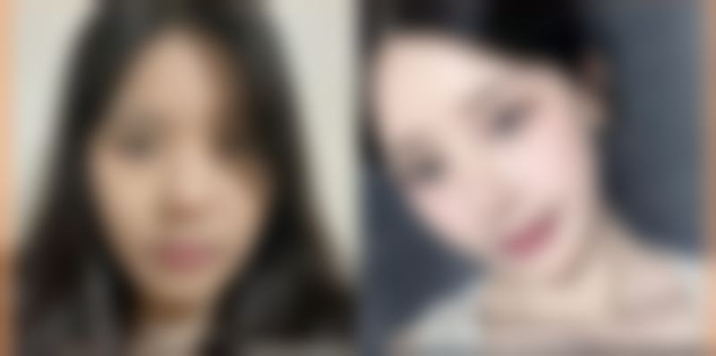 韩国世涟皮肤科整形医院怎么样求美者反馈