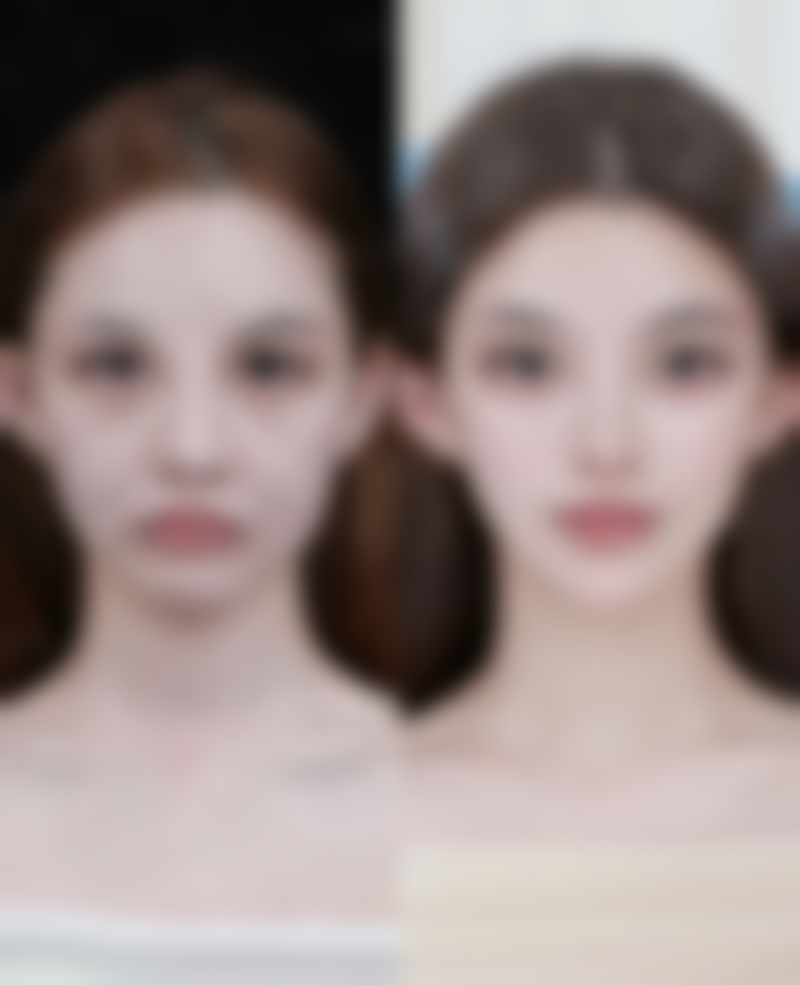 韩国世涟皮肤科整形医院怎么样来院路线