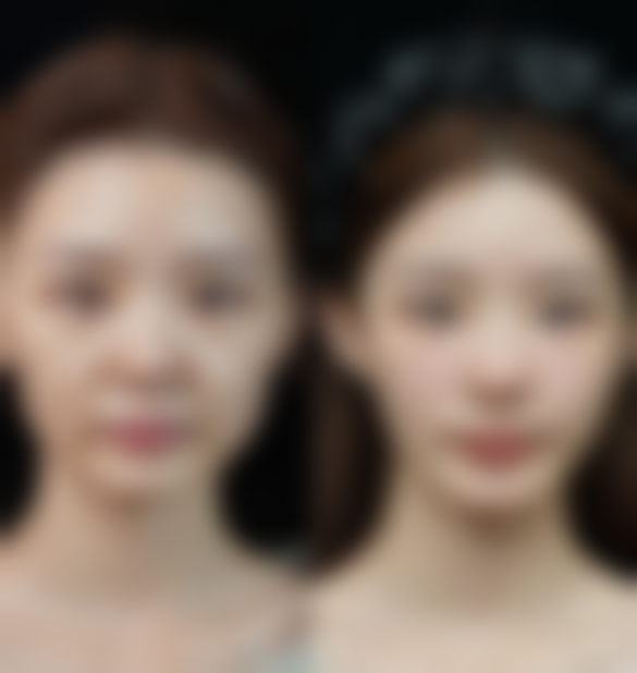 济南市106医院腋臭诊疗中 心怎么样求美者反馈