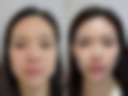 卢志稻医生擅长的医美项目