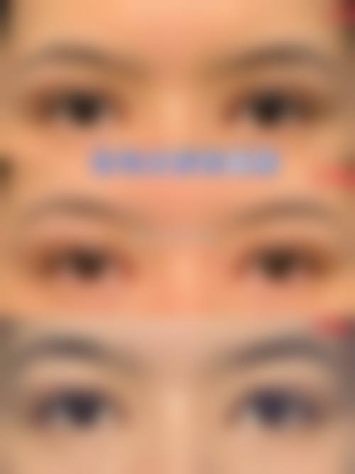 李芸医生出色的特色技术