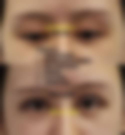 河南中医学校第一附属医院整形美容外科怎么样特色项目及技术优势