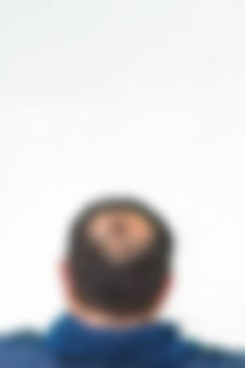 周启明医生助力的美丽蜕变实例