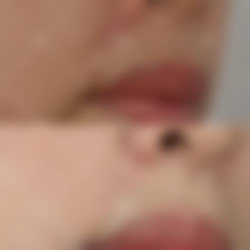 安康红十字会医院整形美容科怎么样来院路线