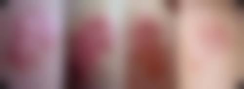 安康红十字会医院整形美容科怎么样医生团队实力