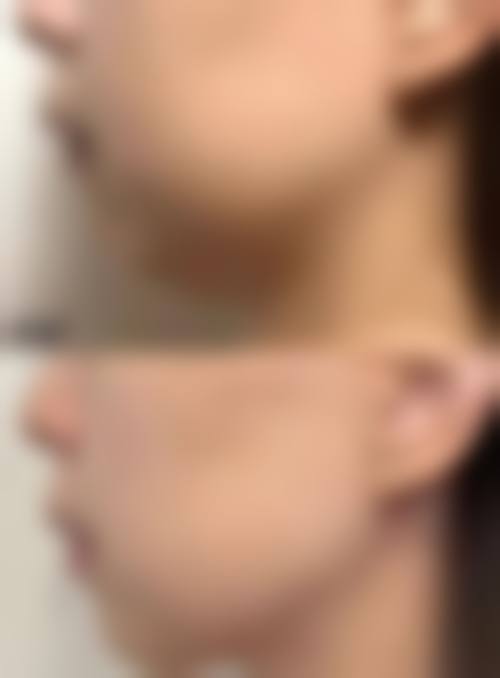 邯郸雅乾医疗美容诊所怎么样价格收费