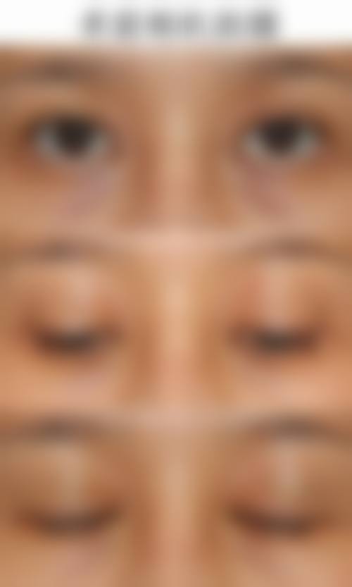 纪影畅医生助您开启美丽之旅