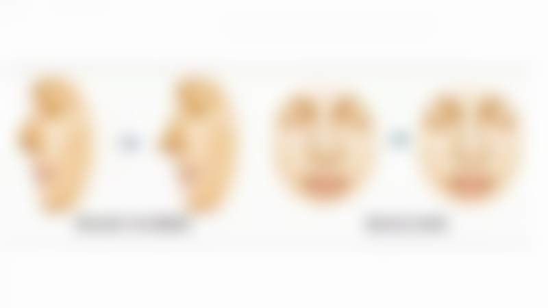 韩国White整形外科怎么样求美者反馈