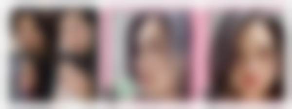 韩国世颜皮肤科医院医生团队实力