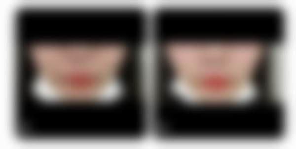 韩国世颜皮肤科医院特色项目及技术优势