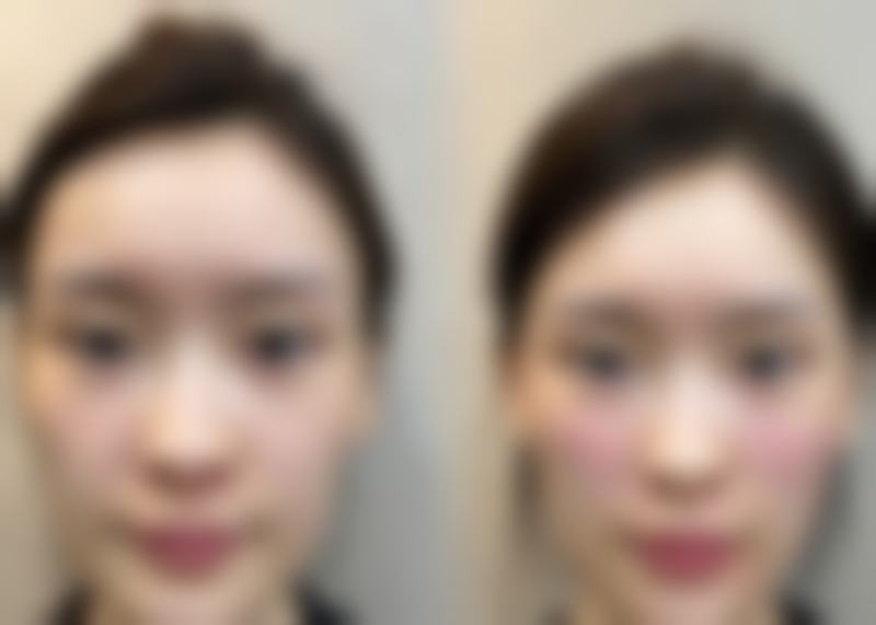 江门新会同济医疗美容门诊部怎么样医生团队实力