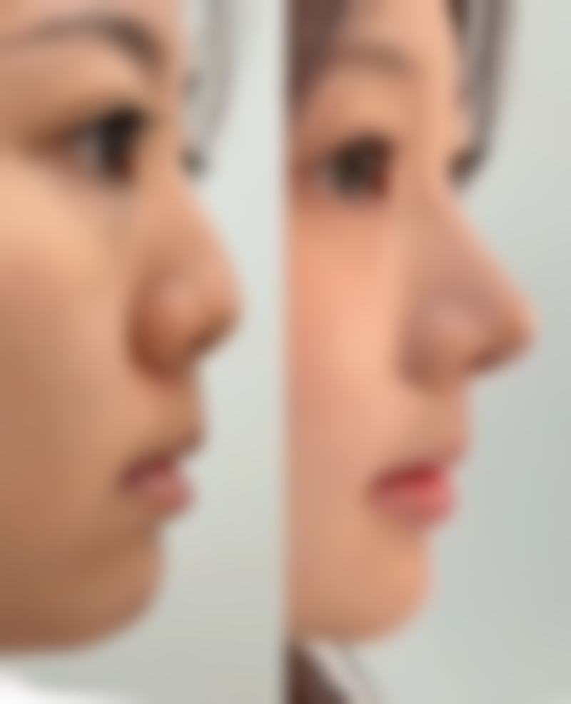 百色芊丽佳人整形医院怎么样特色项目及技术优势