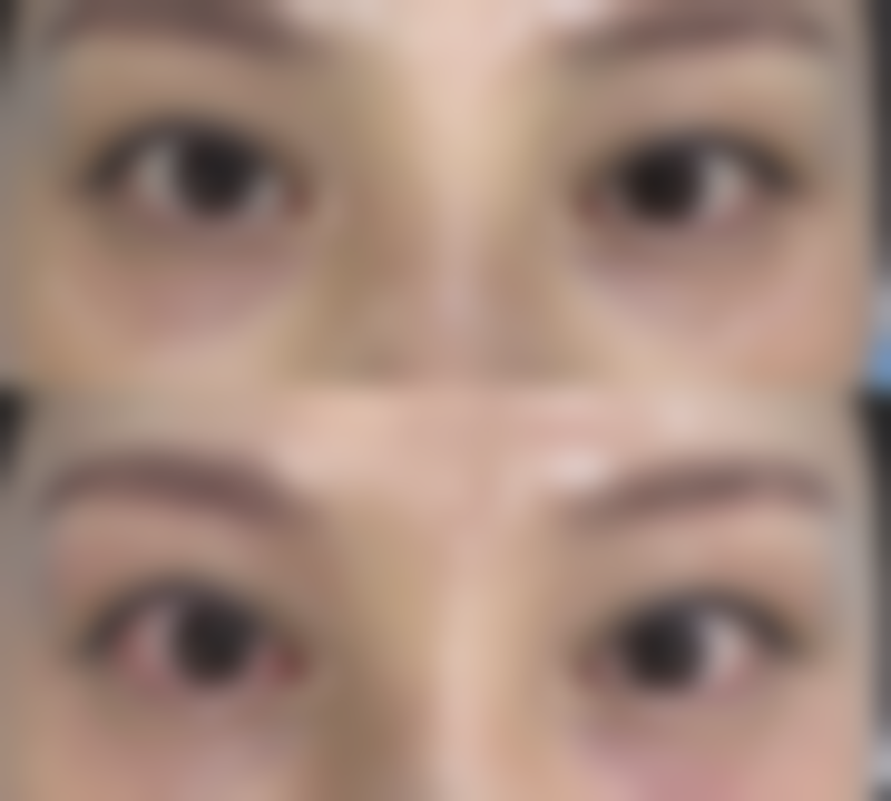 百色芊丽佳人整形医院怎么样医生团队实力