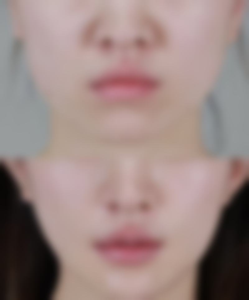 宜昌华美美星整形美容医院怎么样来院路线