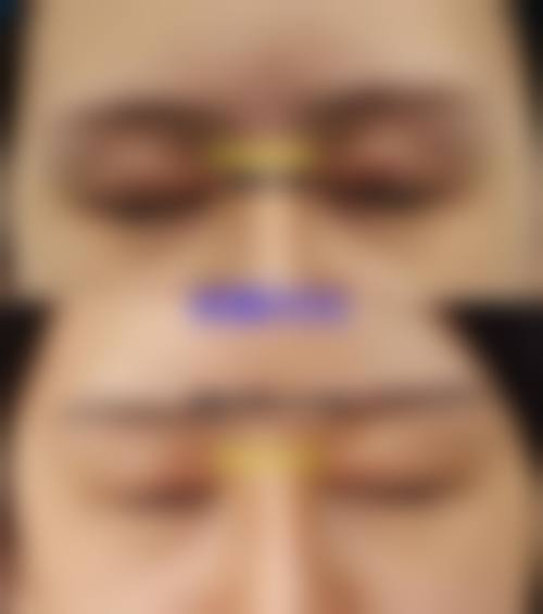 济南新颜整形医院怎么样价格收费