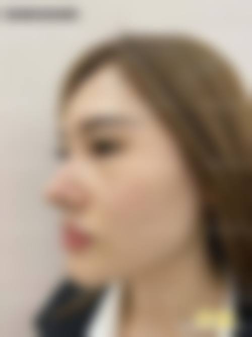 戚振医生的成功实例见证