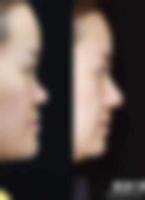 戚振医生擅长的整形领域