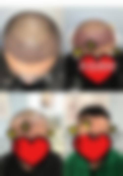 牛改医生解决的多种毛发难题