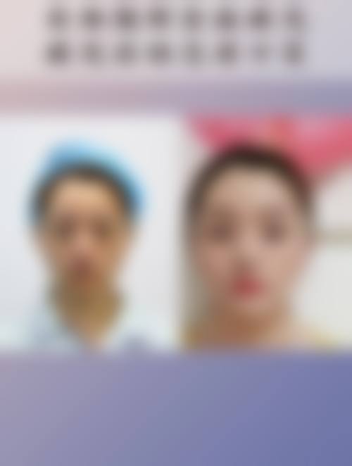 长沙赫美医疗美容门诊部求美者反馈