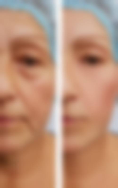 宁德柘荣县卫协会医学美容医院求美者反馈