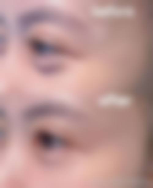 宁德柘荣县卫协会医学美容医院来院路线