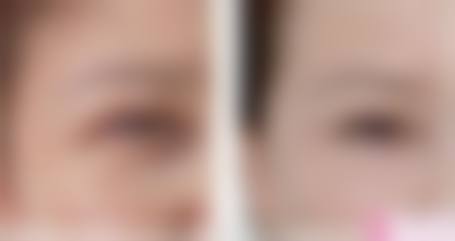 宁德柘荣县卫协会医学美容医院价格收费