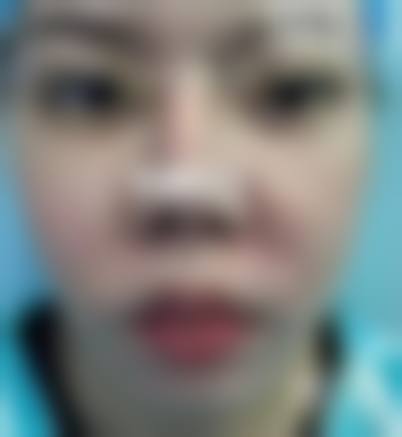 贵阳应超小李飞刀医疗美容诊所求美者反馈