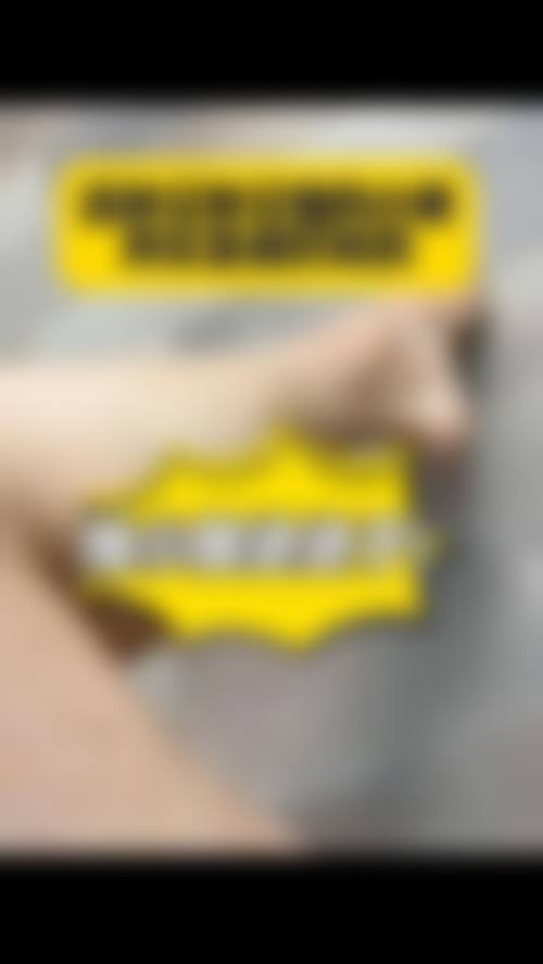 太原大麦微针植发（原科发源植发）怎么样求美者反馈