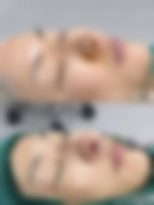 雅安驰雅丽人医疗美容诊所价格收费