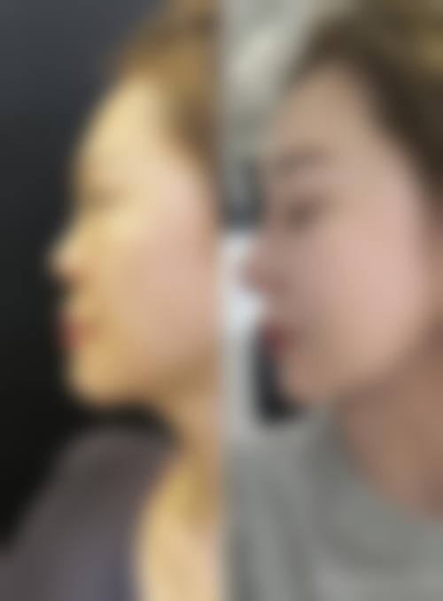 三亚比菲利医疗美容门诊部价格收费