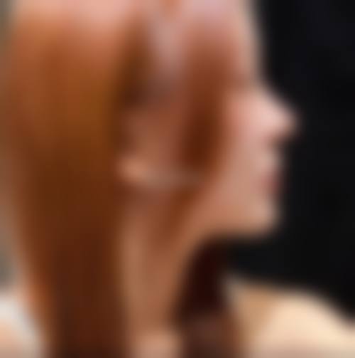 太原大麦微针植发（原科发源植发）怎么样来院路线