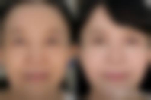 贵阳应超小李飞刀医疗美容诊所特色项目及技术优势