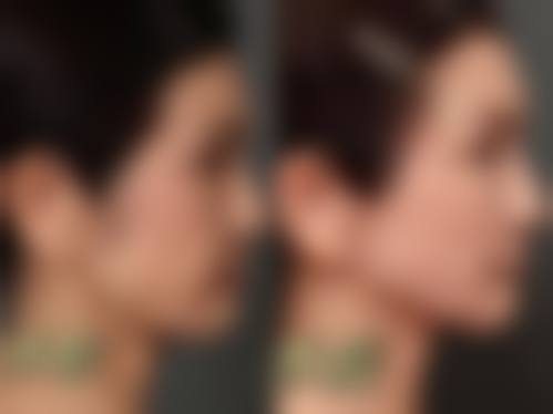 苏州同济医院美容求美者反馈