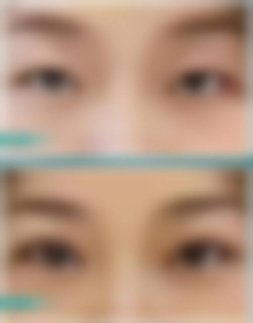 秦雷医生助力您的美丽之旅