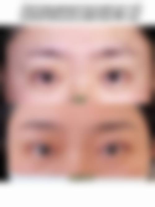 李艳莲医生的擅长领域