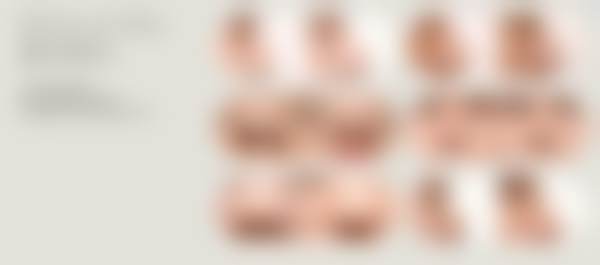 韩国原辰整形医院特色项目及技术优势