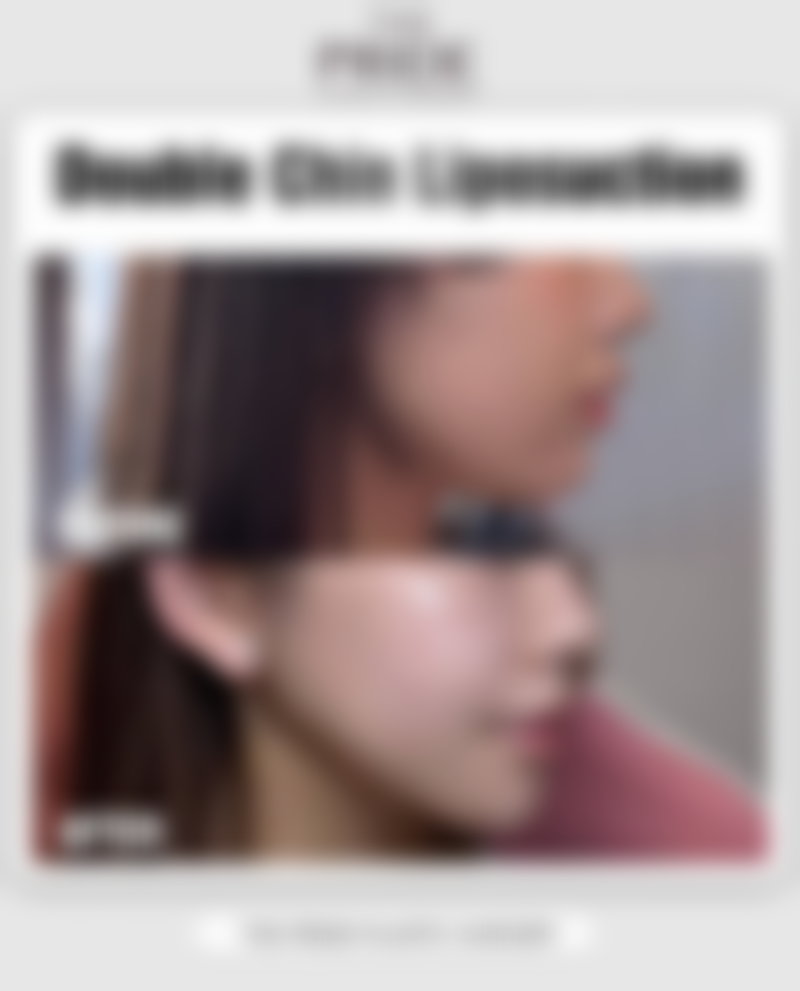 湘潭市非常好人民医院整形美容科怎么样价格收费