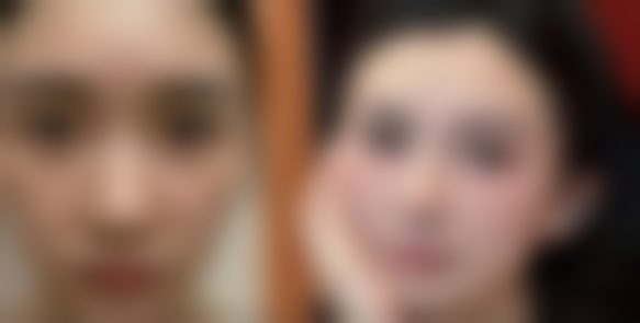 海南海口雪梦夕整形医院怎么样特色项目及技术优势