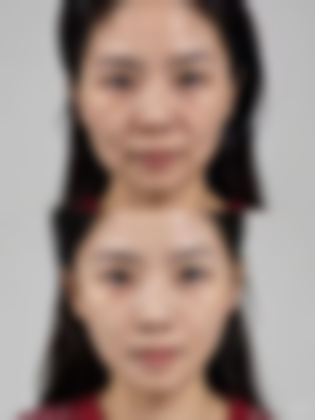 淄博张店千和整形医院特色项目及技术优势