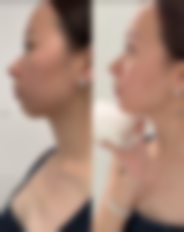 广州轻雅医疗美容门诊部求美者反馈