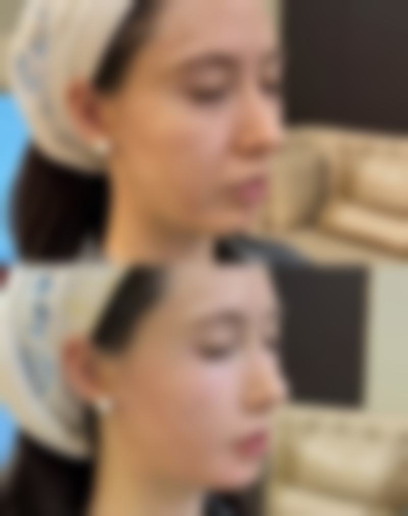 太原美客博仕医疗美容价格收费