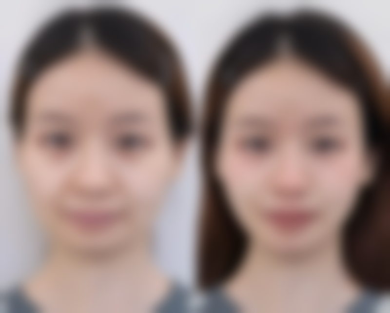 太原美客博仕医疗美容医生团队实力