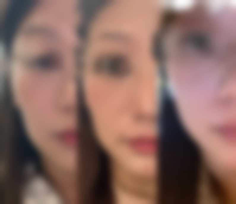 秦雷医生擅长的医美领域