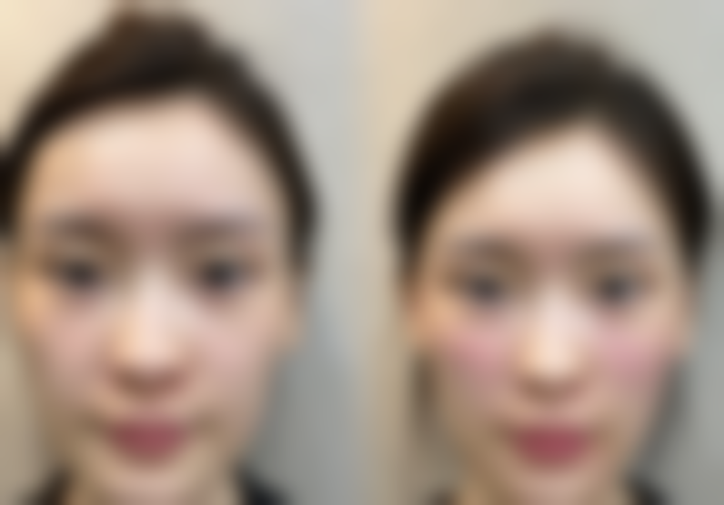 王艺颖医生带来的成功实例